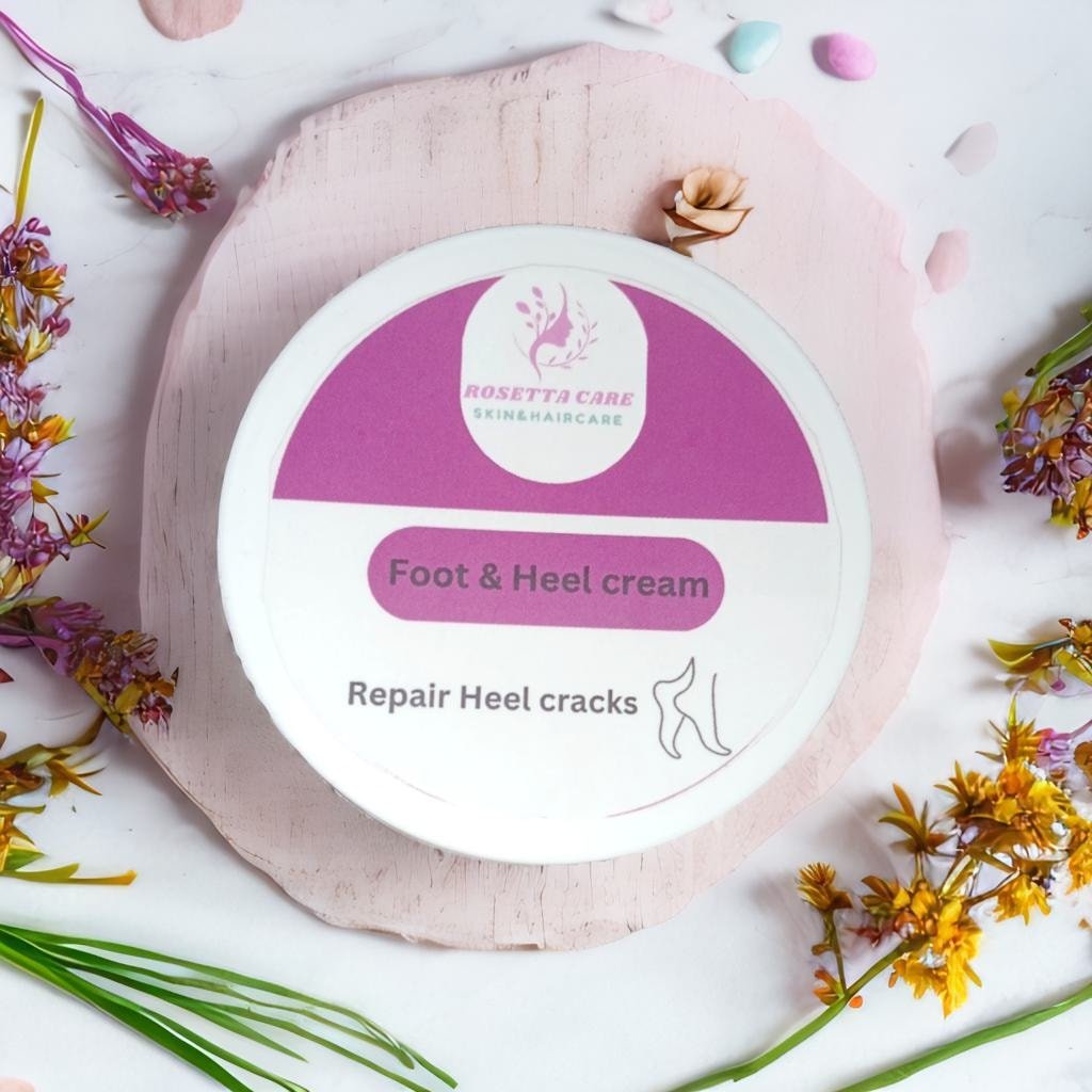 كريم التشققات